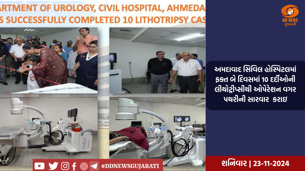 અમદાવાદ સિવિલ હોસ્પિટલમાં ફક્ત બે દિવસમાં 10 દર્દીઓની લીથોટ્રીપ્સીથી ઓપેરેશન વગર પથરીની સારવાર  કરાઇ
