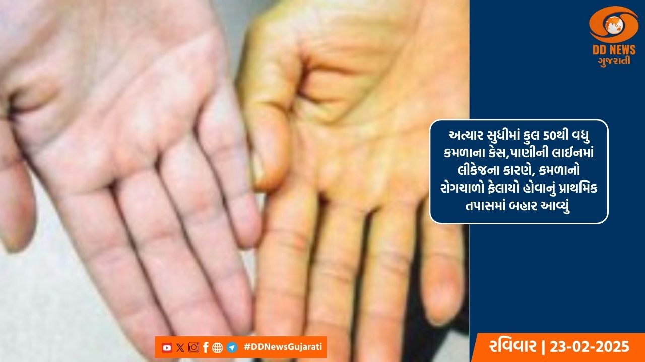 આણંદ જિલ્લાનું ધર્મજ ગામ કમળાના વાવરમાં સપડાયુ